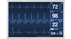 Patient Monitoring